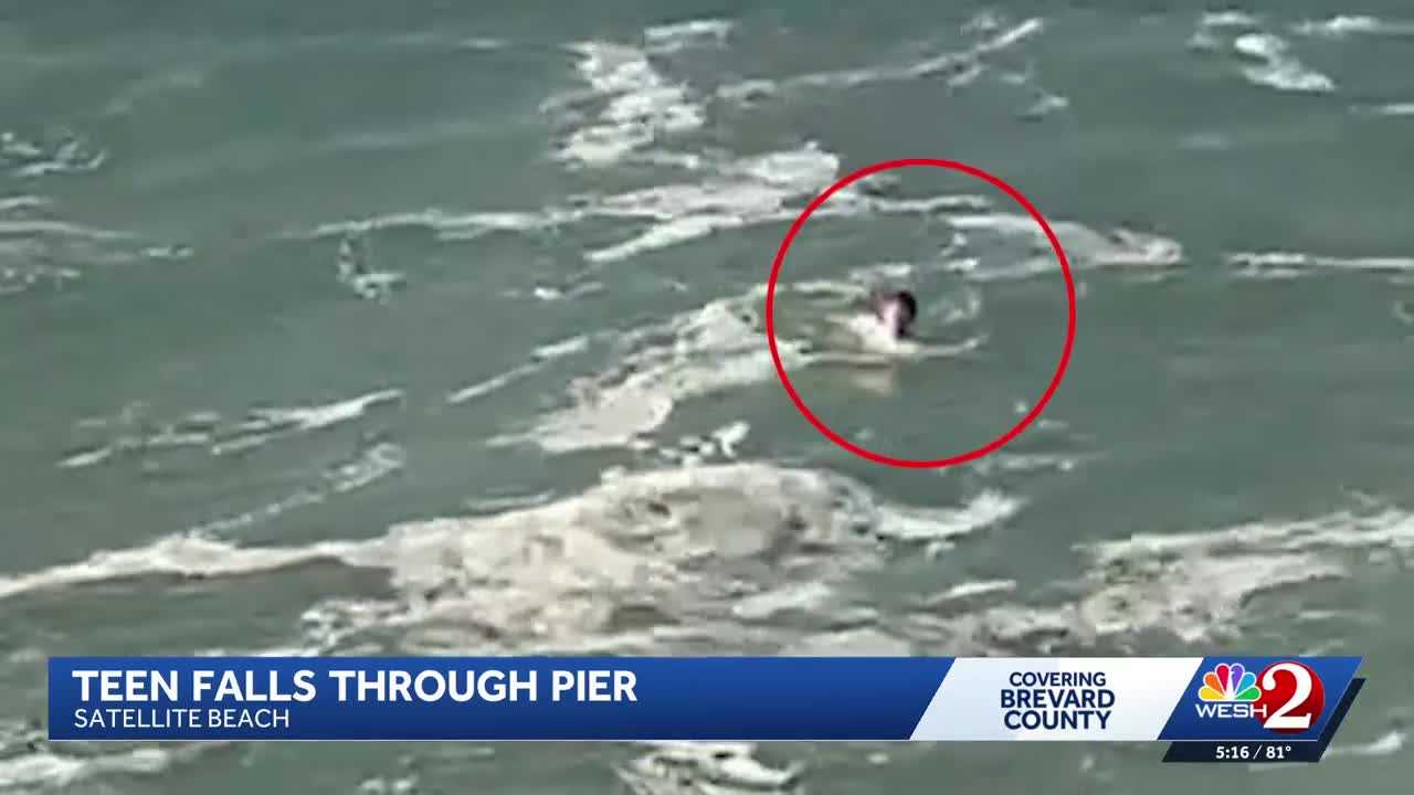 Teenager recovering after falling through a pier at Cocoa Beach, Florida